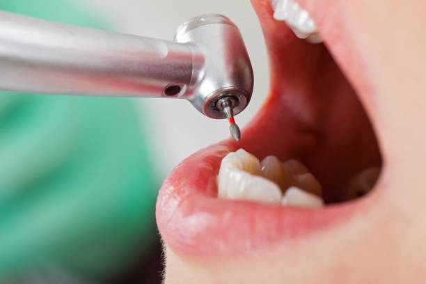 Best Same-Day Emergency Dental Services in Coto De Za, CA